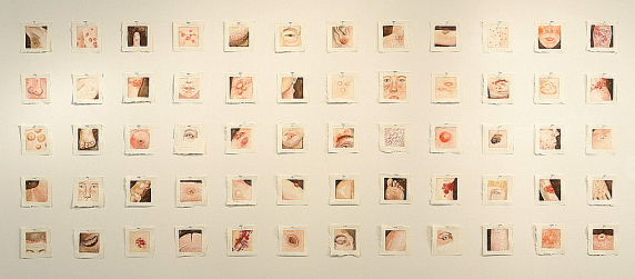 Disease and Disorder Installation disease_and_disorder.jpg