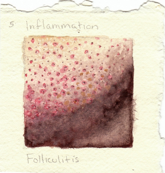 folliculitis.jpg