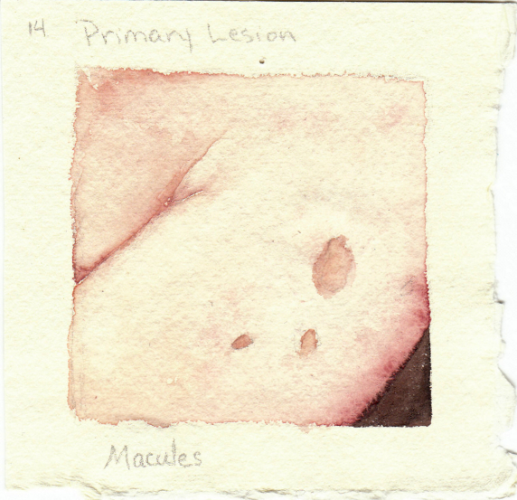 macules.jpg