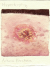 Actinic Keratosis actinic_keratosis.jpg