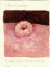 Basal Cell Carcinoma basal_cell_carcinoma.jpg