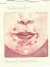 Perioral Dermatitis perioral_dermatitis.jpg